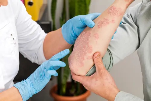 Dix conseils pour faire de votre consultation chez le dermatologue un succès